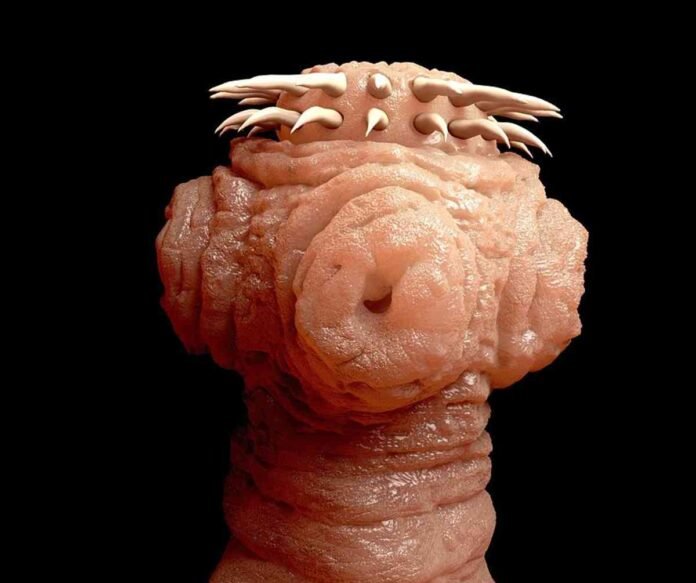Parassiti intestinali Parassiti intestinali