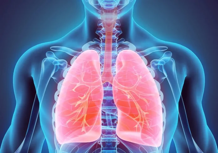 Mesotelioma, patologia asbesto correlata